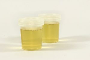 sub solution urine sample